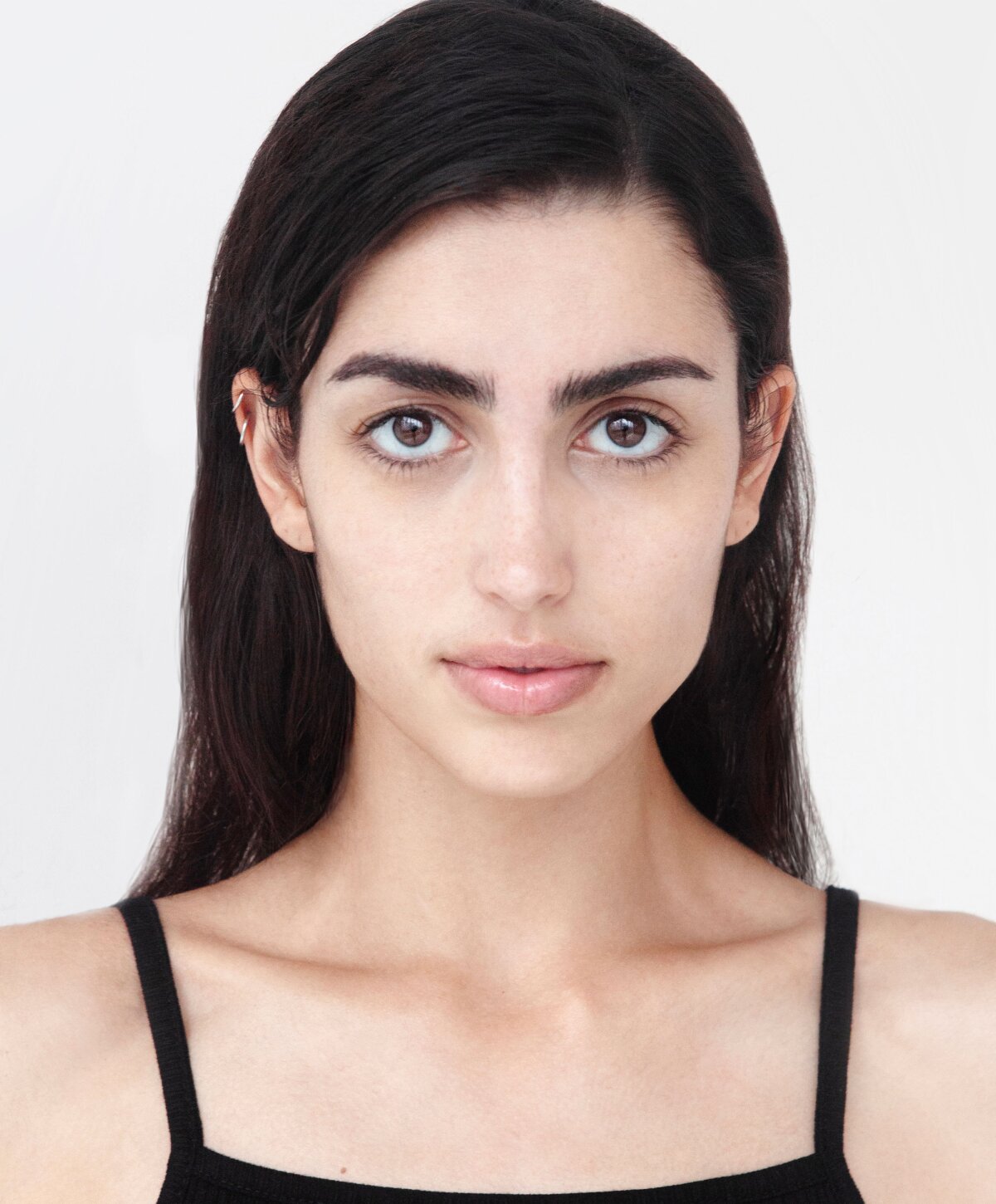 Laser Hair Removal Glen Town Center Glenview, IL & Highland Park, IL